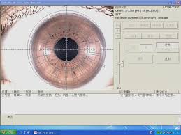 How To Use The Free Iridology Software For Dm880au Video