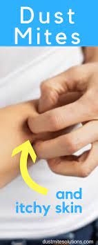 Dust Mite Allergy Symptoms Itchy Skin How I Manage My Allergy