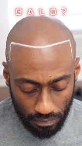 //B O O K N O W, ✖️Chris drove from Cleveland, Ohio, once a week for three  weeks to White Plains, New York, to see me for his SMP. The effort he made  was genuinely humbling, and it inspired me. Thank ...