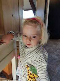 Thus people who have williams syndrome have only one copy of the genes in this region. Toddler With A Condition So Rare It Doesn T Even Have A Name Daily Mail Online