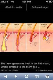American laser centers offers laser hair removal, treatment for cellulite, and microdermabrasion through its 220 clinics across the country. Pin On Stetic