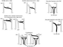 In mycology, anastomosis is the fusion between branches of the same or different hyphae. Schematic Drawings Of The Types Of Anastomosis Of Martin Gruber Mn Download Scientific Diagram
