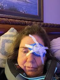 Sorry to hear about your detached retina surgery. Unable to attend reunion