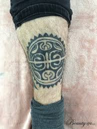 Answered by celibre medical corporation. Laser Tattoo Removal In Canterbury By Qualified Technicians
