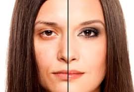 Radiesse Before and After—and More!