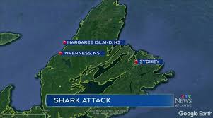 Despite their rarity, many people fear shark attacks after occasional serial attacks, such as the jersey shore shark attacks of 1916, and horror fiction and films such as the jaws series. Rehmkjq2uozikm
