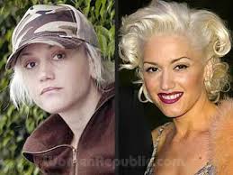 Shelton is reportedly quite unhappy with stefani's changing looks and love of plastic surgery. World Celebrity Gwen Stefani Plastic Surgery