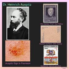 Image result for Auspitz Sign