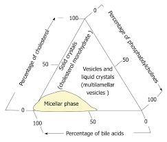 Concept Of The Pathogenesis And Treatment Of Cholelithiasis