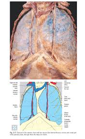 Anatomy Of The Pleura Anatomy Drawing Diagram