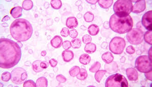 Image result for Peripheral Smear