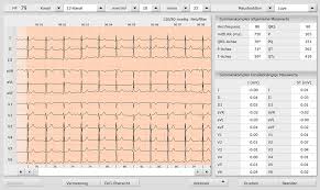 Electrocardiography is the process of producing an electrocardiogram (ecg or ekg). Elektrokardiografie Ekg Kardiologisch Angiologische Praxis