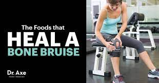 When left alone, a bruise will usually fully heal within two weeks, dr. How To Heal A Bone Bruise Naturally Dr Axe