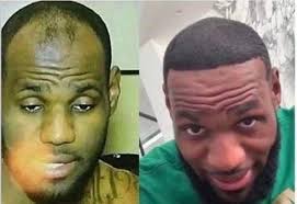 Lakers Rebounding Back in the NBA Playoffs