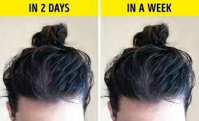 Washing the hair after wearing a hat, helmet, or headscarf is also a good idea. 7 Reasons Why Hair Gets Greasy So Fast And What Can You Do About It