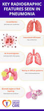 Image result for Pneumonia