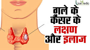 Unfortunately, every complaint or symptom of cancer can be explained by a harmless condition as well. Gale Ki Ganth Cancer Kay Lakshan Your Vigrx Online Store June 09 2020