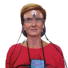 B mode ultrasound image of a trigger point located in the supraspinatus... 