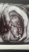 Aufrufe 13 tsd.vor 3 years. 3d 13 Ssw Geschlecht Erkennbar Forum Schwangerschaft Urbia De
