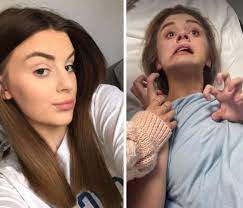 Taplin ingested a spiked drink at the club and reported that she felt hot and sick before her vision blurred. Kbgae Tqe332 M