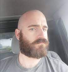 Reddit The Front Page Of The Internet Bearded Men Hot Beard Balding