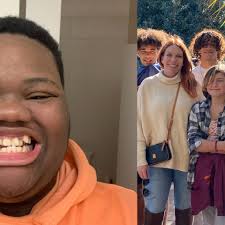 Fundraiser by STEPHANIE DARDEN : Help Eric gain a smile that amplifies  confidence