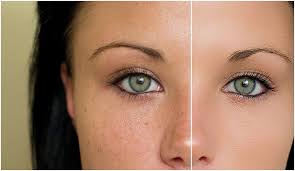 With these free photoshop actions, the software will remember your adjustments just by one click of a button. Your Digital Photography Magazine Clarity Community And Blog Photoshop Actions Skin Skin Retouching Realistic Photoshop