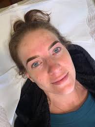 Bronsun staying power