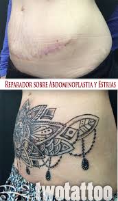 Tatuaje Sobre Estrias Y Cicatriz Por Abdominoplastia Twotattoo