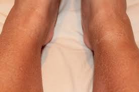 12 Common Spray Tan Problems And How To Fix Them Spray Tan Tips Tanning Dry Skin Spray Tanning