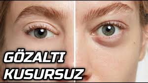 Goz Alti Kusurlarinizi Yok Etmek Istiyorsaniz Bu Video Tam Size Gore 100 Dogal Cilt Bakimi Youtube