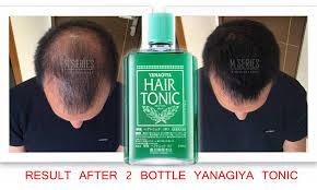 It has been around for quite some time and hasn't changed a bit in all these years. Yanagiya Hair Tonic 240ml 100 9009 Stores Malls Facebook