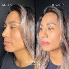 Sublime Plastic Surgery added a...