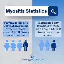 Image result for Polymyositis
