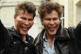 Twins Bogdanoff Plastic Surgery Celebrity Plastic Surgery Cosmetic Surgery