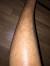 Razor Bumps On Legs Itchy