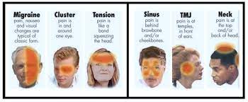 Posture Headaches The Relationship