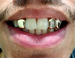 Choose grillz for 4 teeth to 20 teeth. Gold Grillz Miami Pa Twitter Call Text 305 989 6479 Address 1754 Ne 163rd St North Miami Beach Fl 33162 Https T Co Aaj8sqngtr Goldgrillzmiami Gold Grillz 14k Goldgrillz Solidgold Quality Best Yellowgold Fresh Custom Qualitygrillz