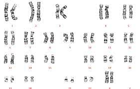The karyotype analysis reveals that males have one x and one y chromosome and females have two x chromosomes with 22 pairs of autosomes. male and female are two different living entities on earth and their difference makes it possible to reproduce. A Karyotype Of A Normal Female 46 Xx Reproduced Courtesy Of Human Download Scientific Diagram