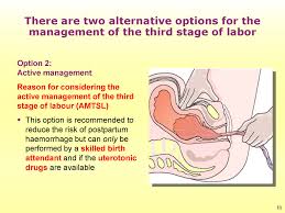 Image result for Active Management of Labor
