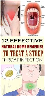 12 Effective Natural Home Remedies To Treat A Strep Throat Infection Throat Infection Strep Throat Natural Headache Remedies