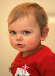 Ruby Morgan Aged 15 Months Who Editorial Stock Photo