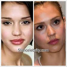 Pin On Celebrity Rhinoplasty Celebrity Nose Job