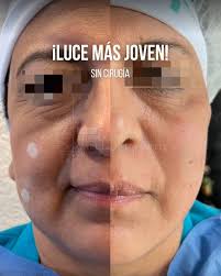 Dr. Michael Garcia-Inda Viticream (@DrGIOSKIN) • Facebook