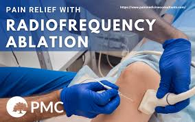 Image result for Radiofrequency Surgery