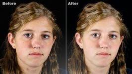 Anzi, volendo si può utilizzare anche per cambiare il anche beauty camera offre solo un paio di funzioni, però ben fatte. Pulizia Del Viso In Foto E Pelle Senza Brufoli E Rughe Navigaweb Net