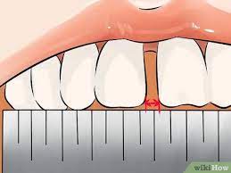 If you can't stop using straws, then at least be sure to position the straw toward the back of the mouth and not resting against your teeth. How To Get Rid Of Gaps In Teeth 14 Steps With Pictures