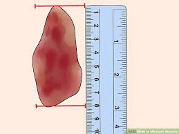 How To Measure Wounds 14 Steps With Pictures Wikihow