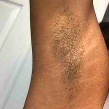 See full list on byrdie.com My Armpits Hurt After Waxing