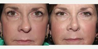 J. Renee Booth, MD, Board Certified Otolaryngologist